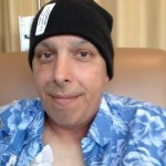 5th week of chemo and radiation